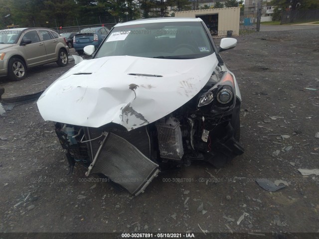 Photo 5 VIN: KMHTC6AE0FU222892 - HYUNDAI VELOSTER 