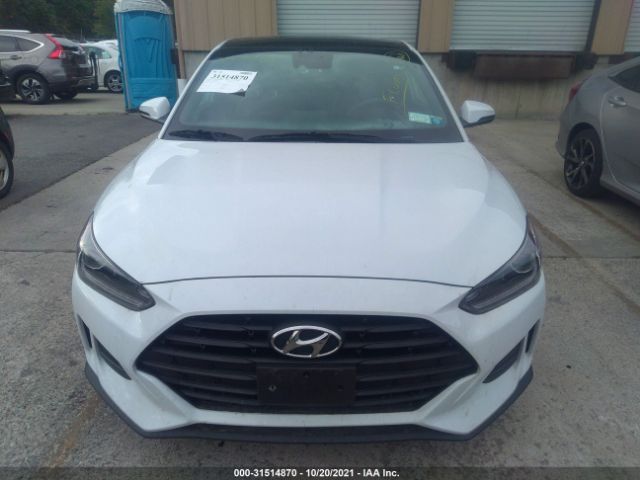 Photo 5 VIN: KMHTG6AF4LU021134 - HYUNDAI VELOSTER 