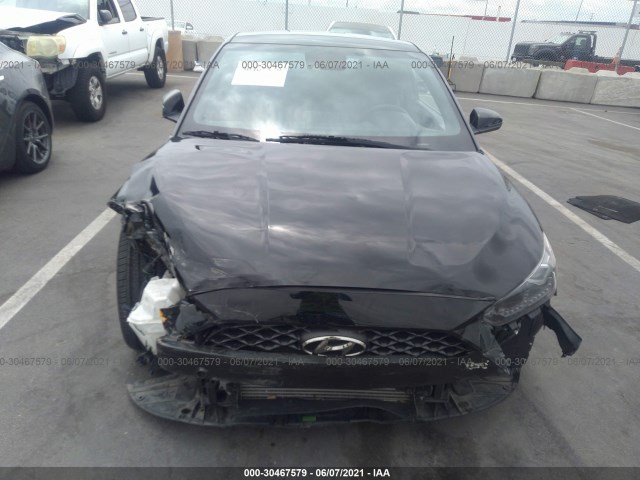 Photo 5 VIN: KMHTH6AB5KU009177 - HYUNDAI VELOSTER 