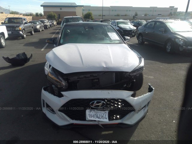 Photo 5 VIN: KMHTH6AB5LU029978 - HYUNDAI VELOSTER 