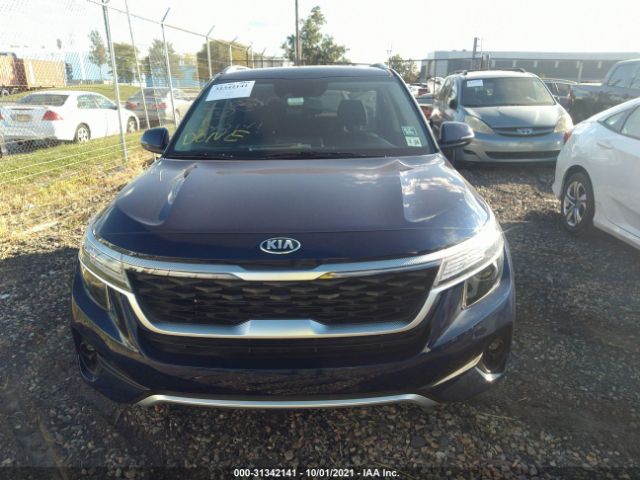 Photo 5 VIN: KNDERCAA4M7185736 - KIA SELTOS 