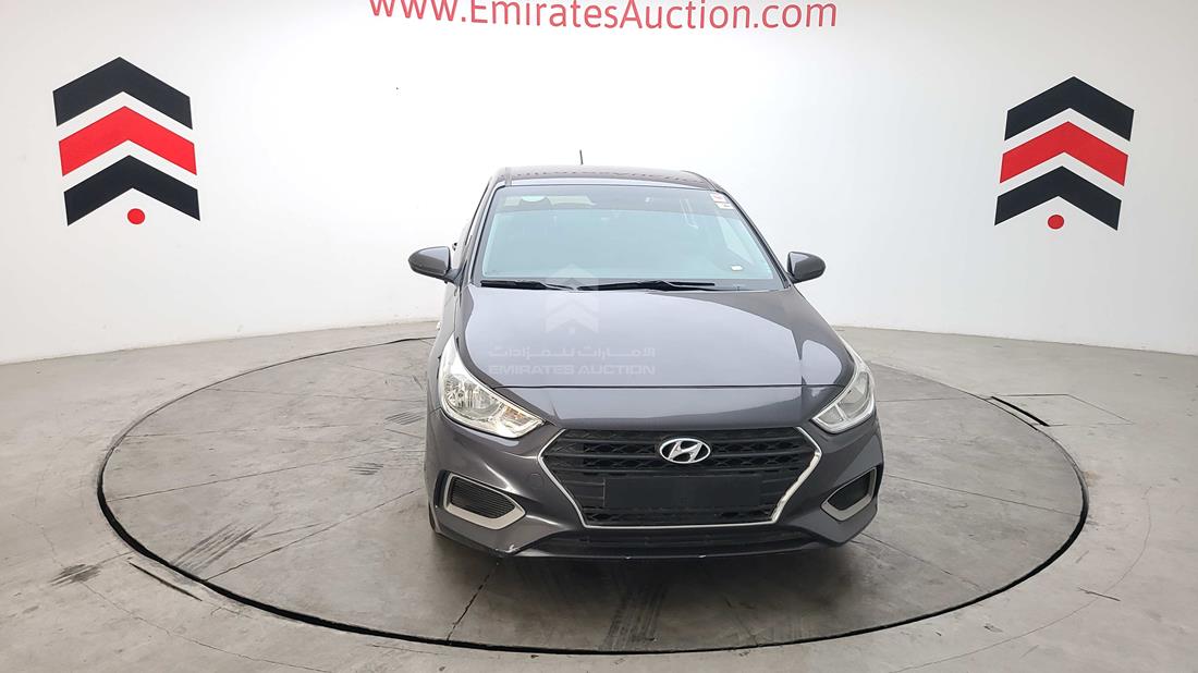 Photo 3 VIN: MALC741B1LM171429 - HYUNDAI ACCENT 