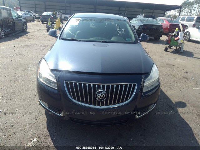 Photo 5 VIN: W04GN5EC6B1010717 - BUICK REGAL 