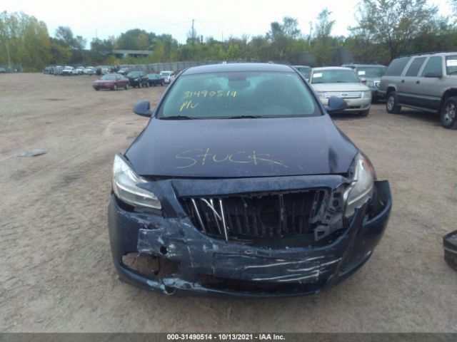 Photo 5 VIN: W04GN5EC6B1126077 - BUICK REGAL 