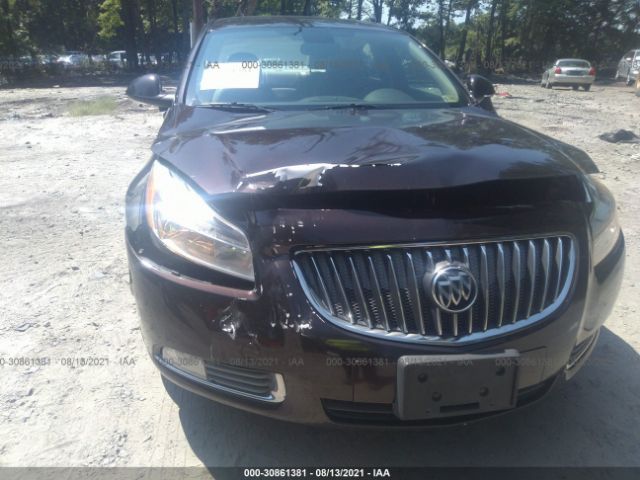 Photo 5 VIN: W04GN5EC6B1142294 - BUICK REGAL 