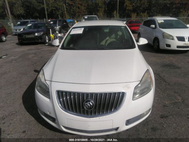 Photo 5 VIN: W04GR5EC7B1013971 - BUICK REGAL 