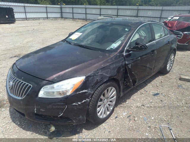 Photo 1 VIN: W04GR5EC9B1125462 - BUICK REGAL 