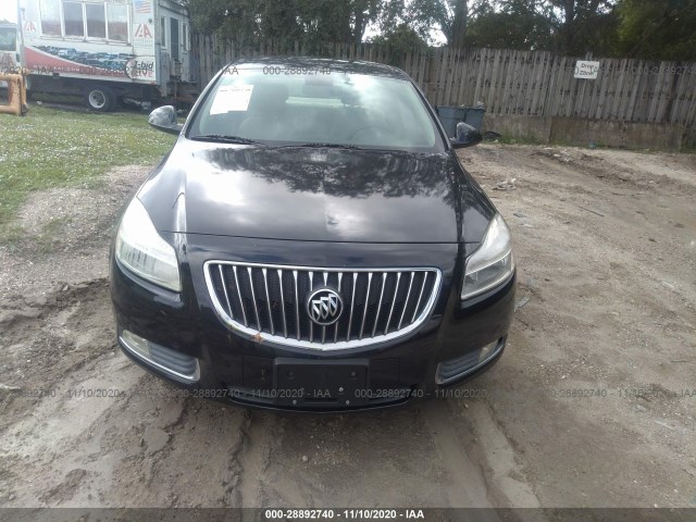 Photo 5 VIN: W04GR5ECXB1012555 - BUICK REGAL 