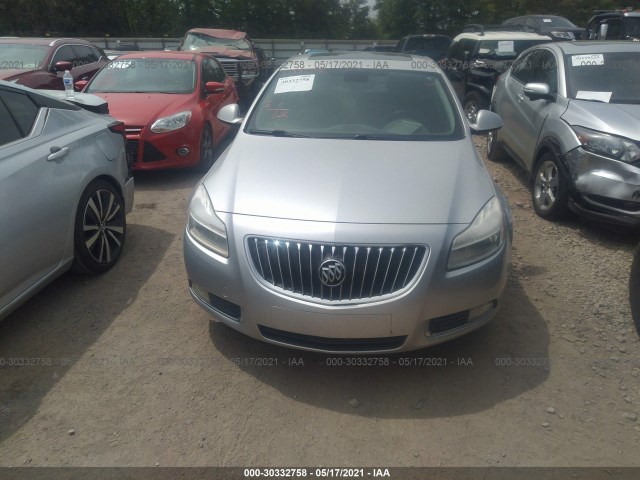 Photo 5 VIN: W04GT5GC9B1005904 - BUICK REGAL 