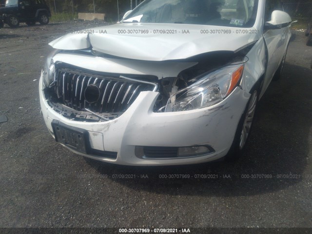 Photo 5 VIN: W04GU5GC0B1010700 - BUICK REGAL 