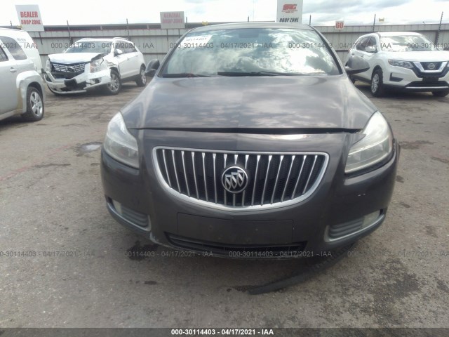 Photo 5 VIN: W04GU5GCXB1047317 - BUICK REGAL 