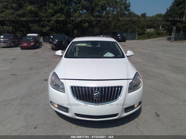 Photo 5 VIN: W04GV5EV0B1052253 - BUICK REGAL 