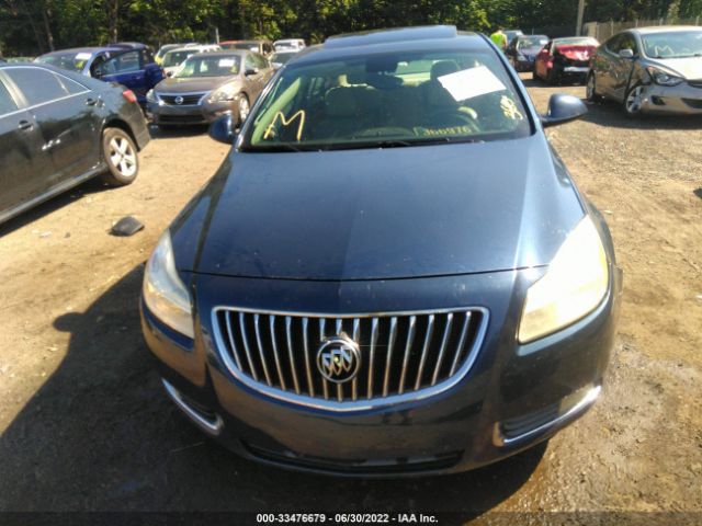 Photo 5 VIN: W04GW5EV2B1115740 - BUICK REGAL 