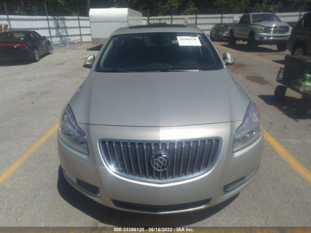 Photo 5 VIN: W04GW5EV9B1124399 - BUICK REGAL 