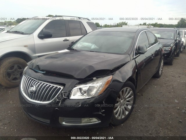 Photo 1 VIN: W04GX5GV2B1040337 - BUICK REGAL 