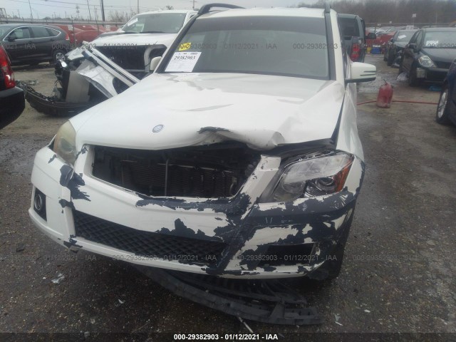 Photo 5 VIN: WDCGG5GB0BF573103 - MERCEDES-BENZ GLK-CLASS 